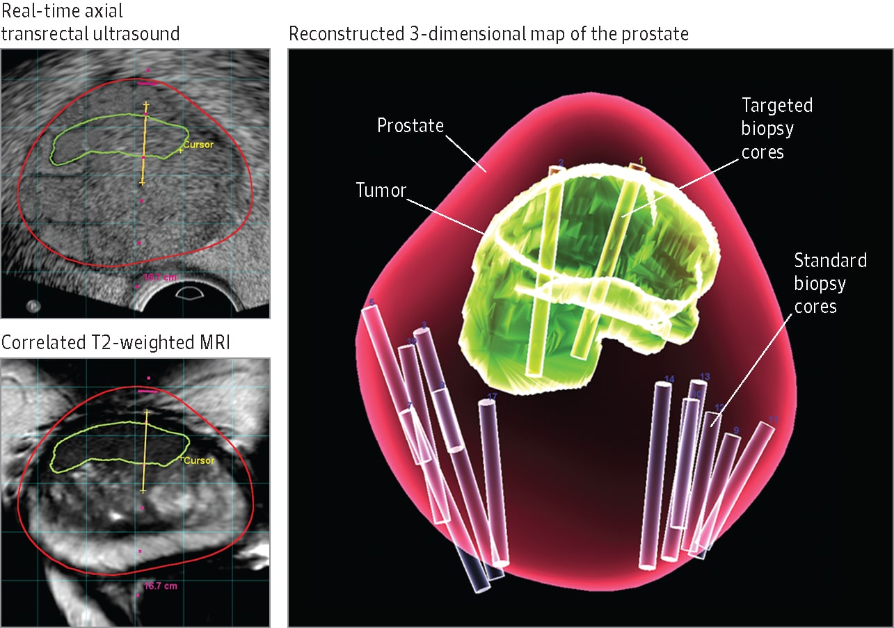 IRM multiparametric de prostată | SANADOR