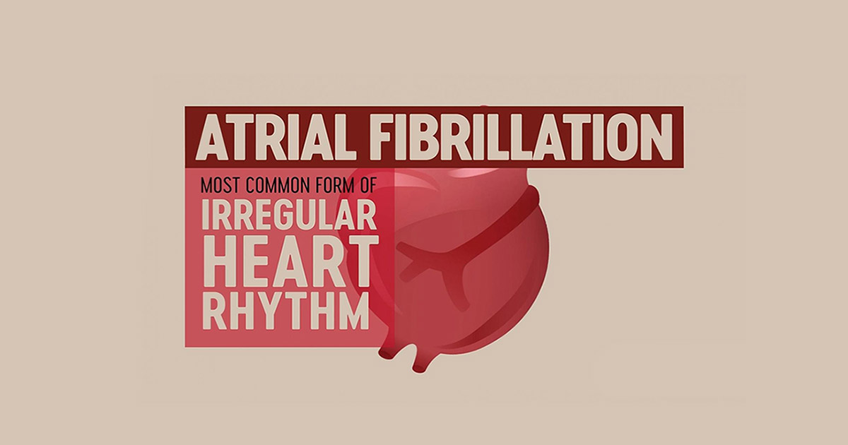 fibrilația atrială ritm cardiac rapid neregulat