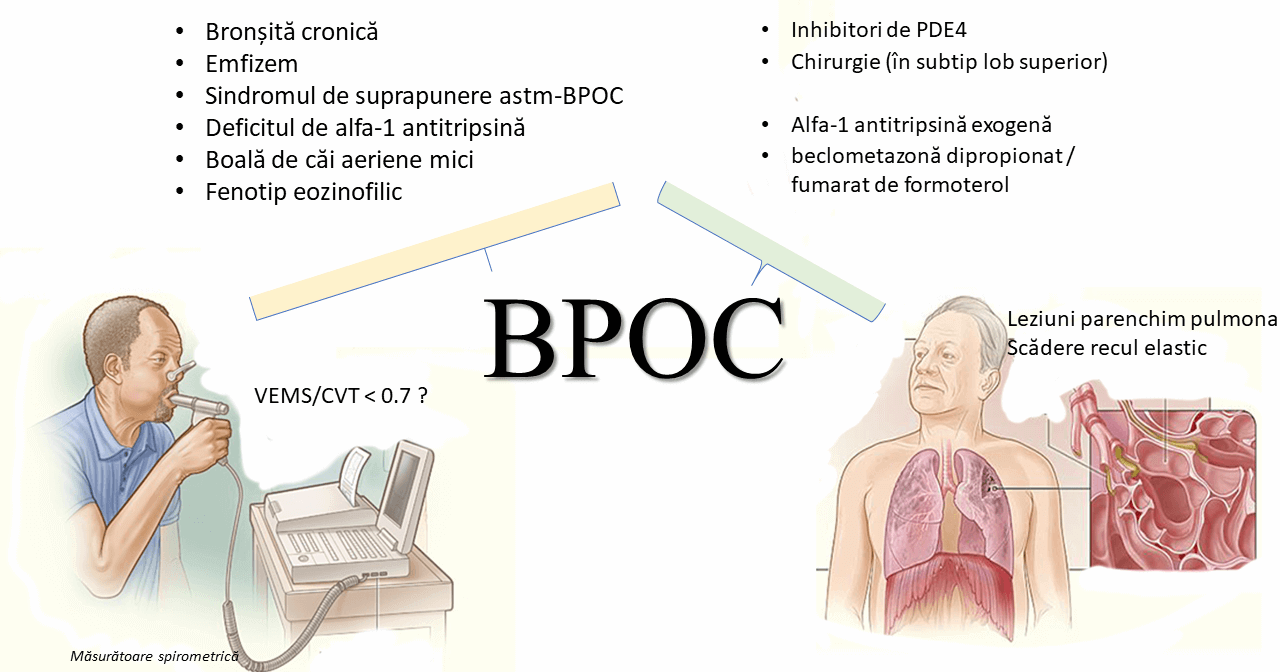 BPOC-fenotipuri-tratament-spirometrie-fiziopatologie.png
