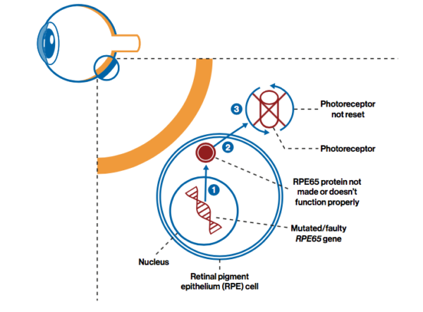 Degenerarea celulelor fotoreceptoare