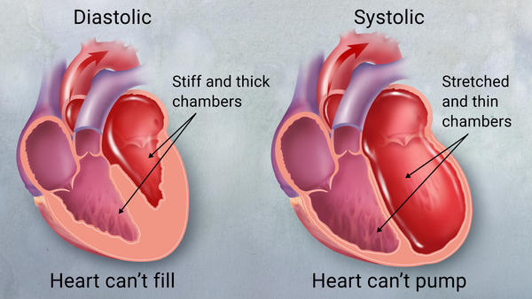 Insuficiența cardiaca congestiva la caine