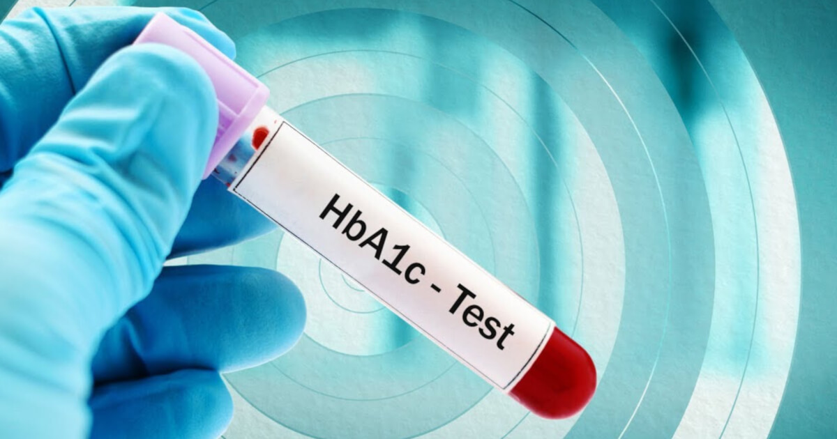 Test HbA1c