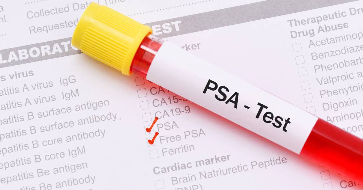 Testare PSA-Prostate Specific Antigen