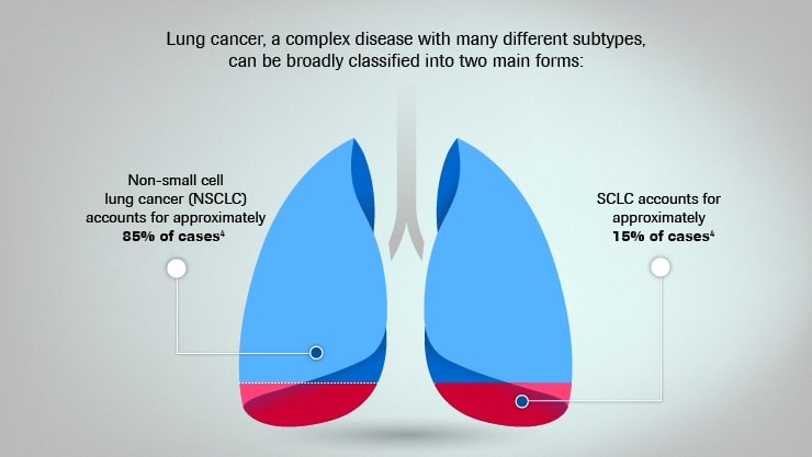 Clasificarea cancerului pulmonar