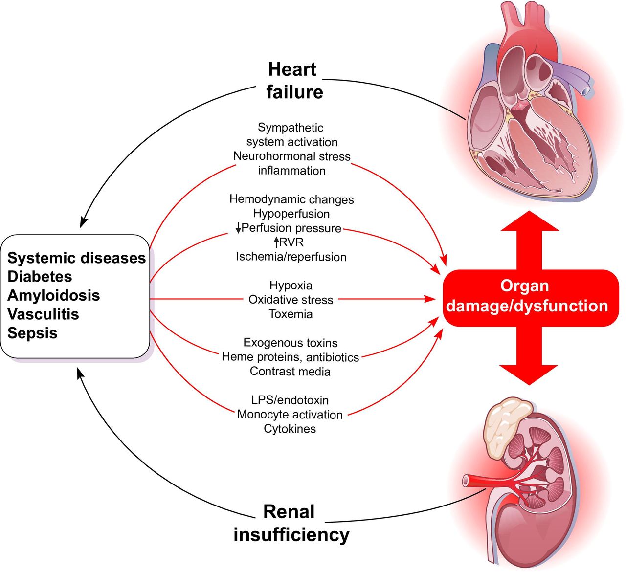 Ilustrarea mecanismelor sindromului cardiorenal