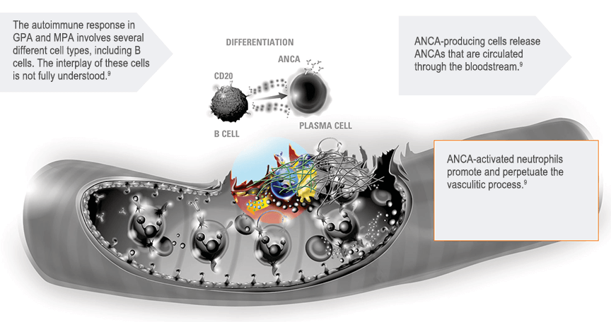cticorpilor ANCA în mecanismul de autoperpetuare a inflamației vasculare în GPA și MPA.