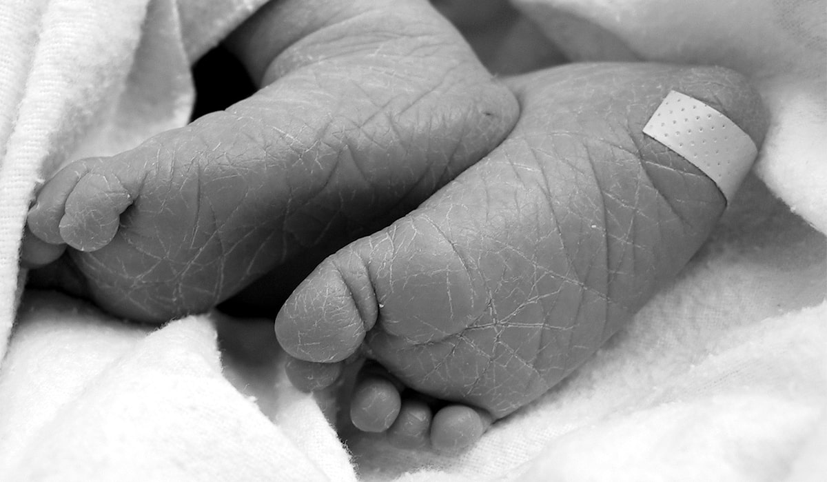 Screening calcâi nou-născuți