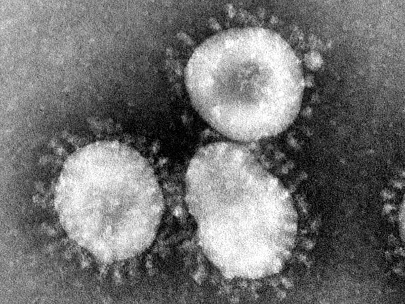 Aspectul coronavirusului la microscopul electronic
