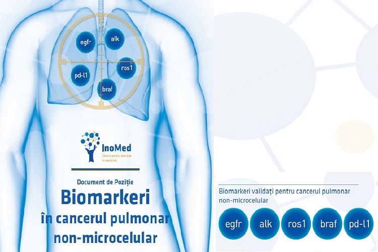 biomarkeri validati in cancerul pulmonar non-microcelular: egfr, alk, ros1, braf, pdl-1