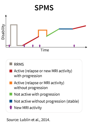 Grafic explicativ scleroza multiplă secundară progresivă