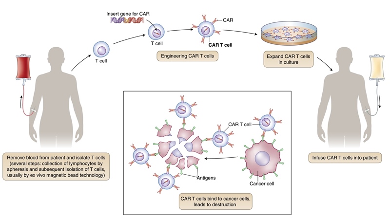 mecanism obținere terapii celulare cancer CAR T Kymriah