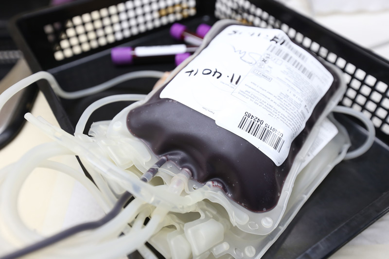 masă eritrocitară transfuzională