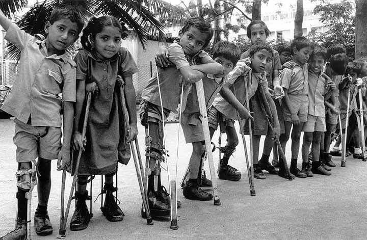 poliomielita istorie copii paralizati