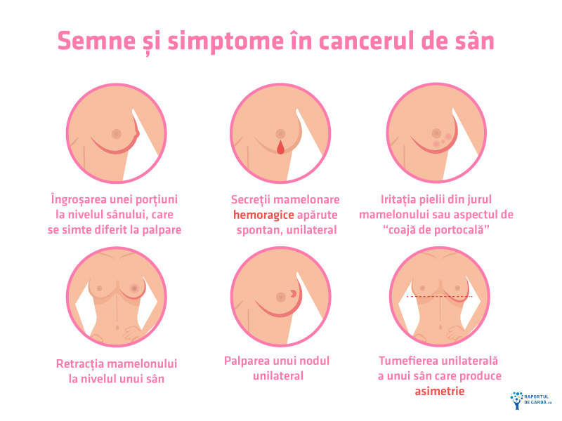 Semne si simptome cancer mamar