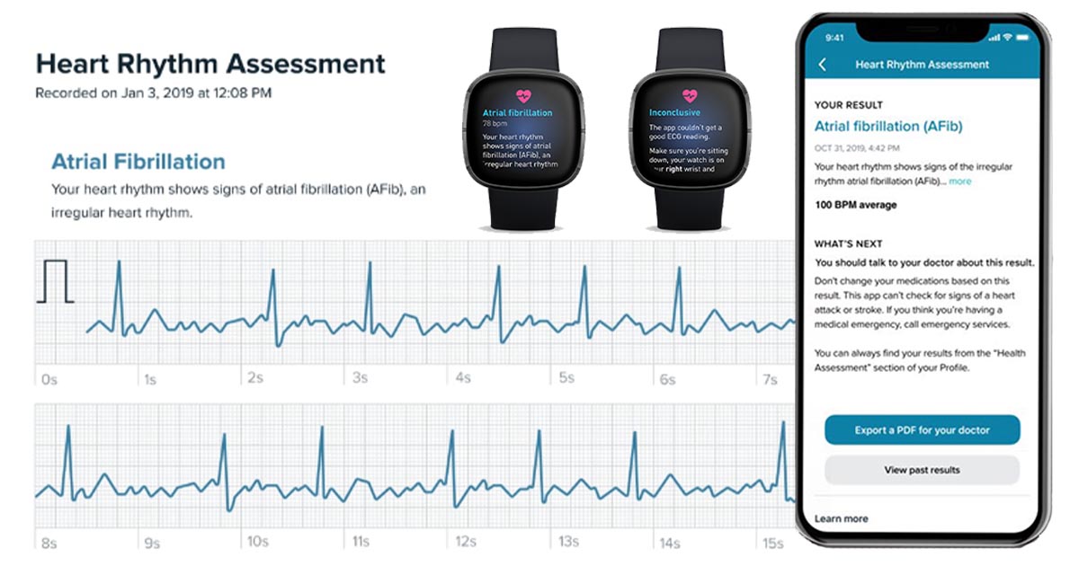 FDA aprobă Fitbit ECG, aplicație pentru monitorizarea ritmului cardiac